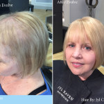 A before image of a woman with thinning hair, and an after image of the same woman with thicker hair