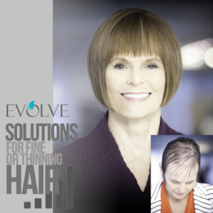 woman before and after evolve system for thinning hair