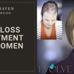 Before and After Evolve Hair Loss Treatment